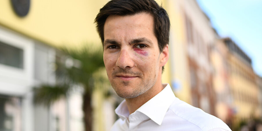 Der neue Bürgermeister in Freiburg, Martin Horn (parteilos), wurde direkt nach dem Wahlsieg im Gesicht verletzt. Foto: picture-alliance/Patrick Seeger/dpa