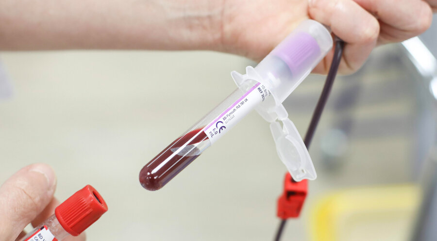 Der nicht-invasive pränatale Test (NIPT) gibt anhand des Bluts der Mutter Auskunft über die Möglichkeit einer Trisomie beim ungeborenen Kind. Foto: Picture Alliance/Manon Cruz