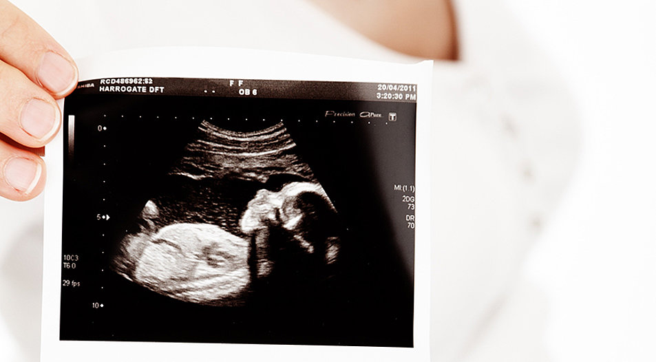 Ein Ultraschallbild von einem ungeborenen Baby. Symbolbild: pixabay.com