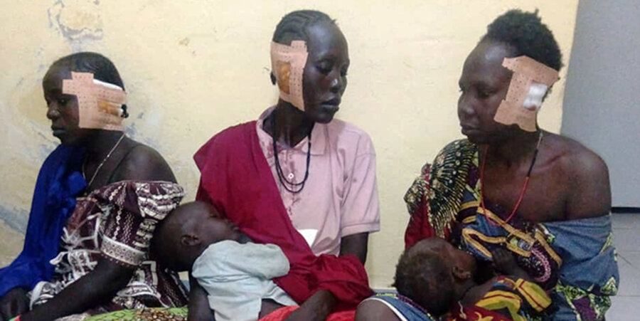 Boko Haram verstümmelte die Frauen, indem sie ihnen ein Ohr abschnitten. Foto: Kirche in Not
