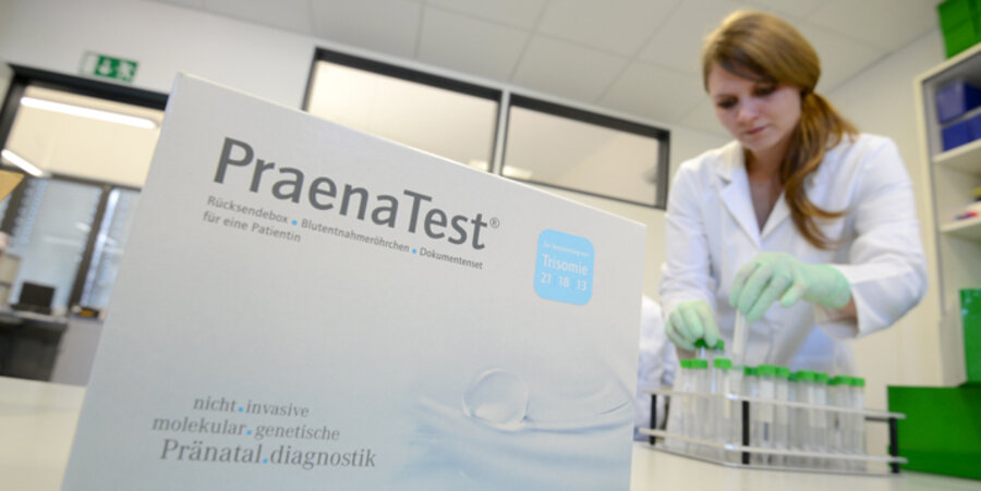 Die Bundestagsabgeordneten befürchten einen steigenden Druck auf Eltern, ein Kind mit Trisomie 21 abzutreiben. Foto: picture-alliance/dpa