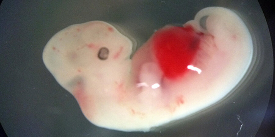 Der Embryo aus Mensch und Schwein - eine sogenannte Chimäre. Foto: picture-alliance/Photoshot