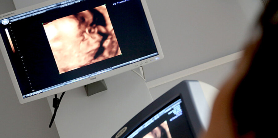 Eine Frau bei einer Ultraschalluntersuchung. Foto: pixabay.com