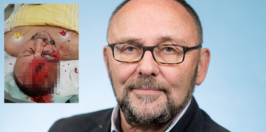 Der Vorsitzende der AfD in Bremen, Frank Magnitz, wurde von unbekannten Tätern angegriffen. Fotos: picture-alliance/Michael Kappeler/dpa; AfD Bremen