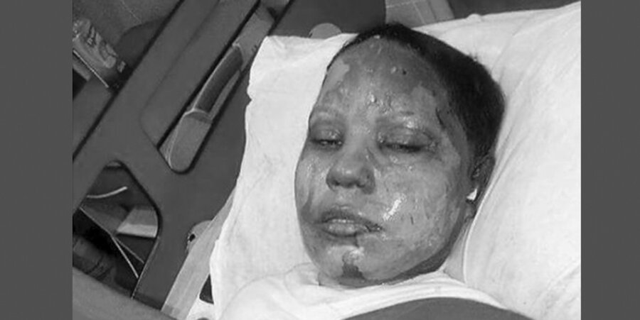Die 24-jährige Asma Yaqoob erlitt massive Verbrennungen und erlag den Verletzungen. Foto: World Watch Monitor